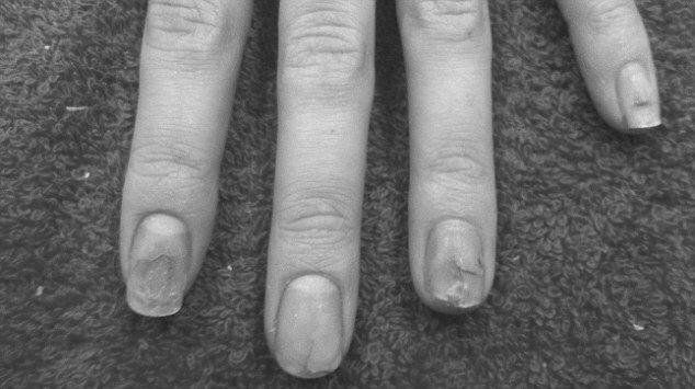 Is nail extension harmful for the nails? image 5