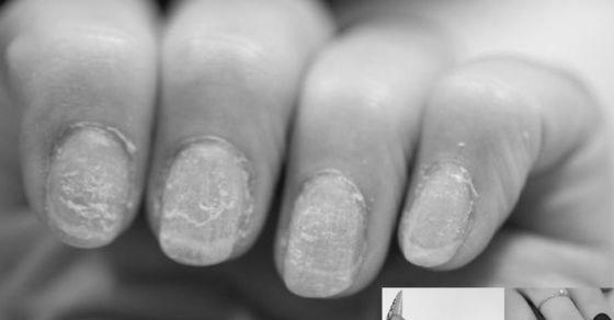 Is nail extension harmful for the nails? image 10