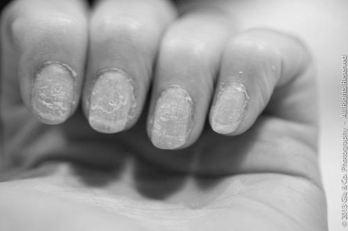 Do gel nails really ruin your natural nails? photo 5
