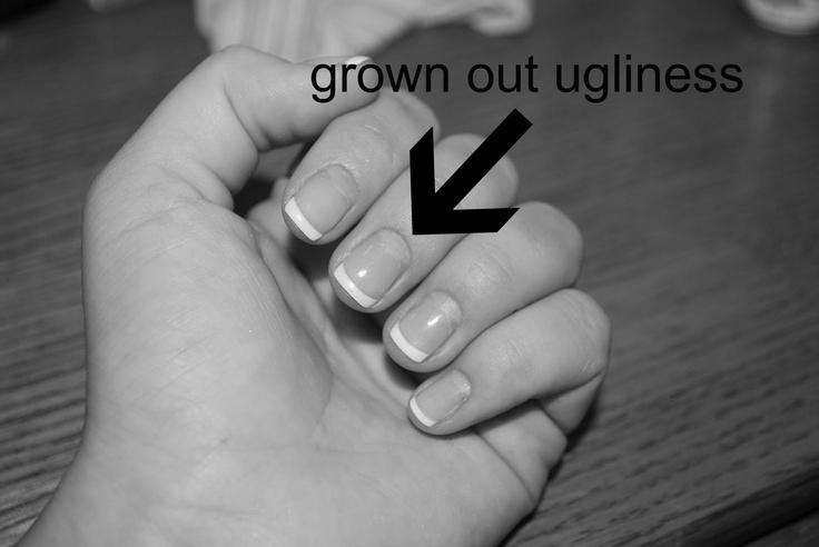 How often should you get UV gel nails filled? photo 1