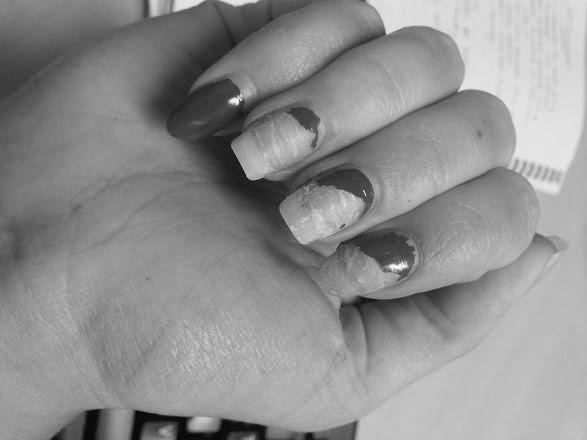 Why do gel nails peel off? photo 5