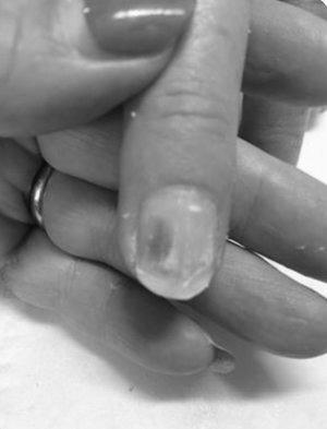 Why do my nails go green under false nails? image 0