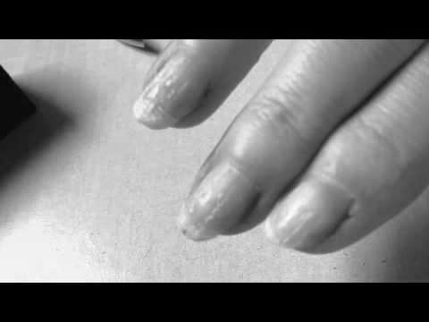 How do you get nail glue off your nails? photo 1