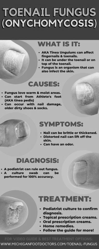 What is the best way to get rid of toenail fungus? photo 7