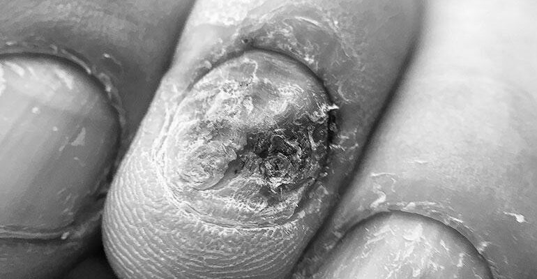 Do manicures harm or help your fingernail’s health? photo 0