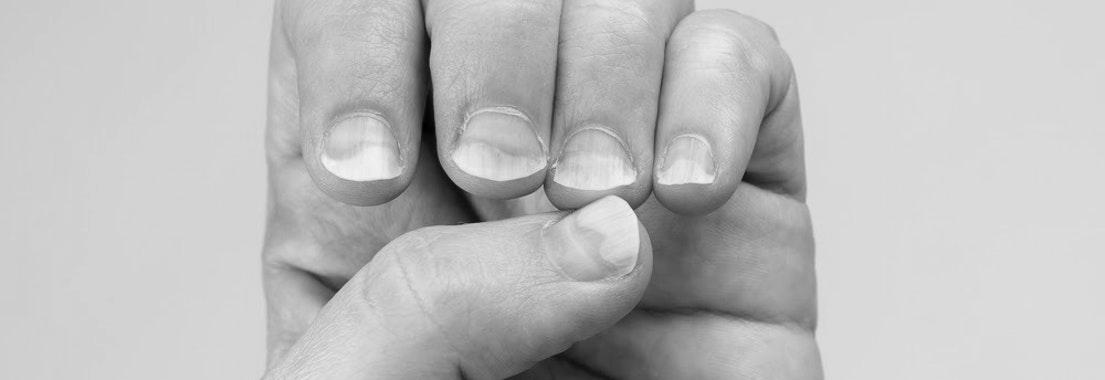 What is nail infection? image 3