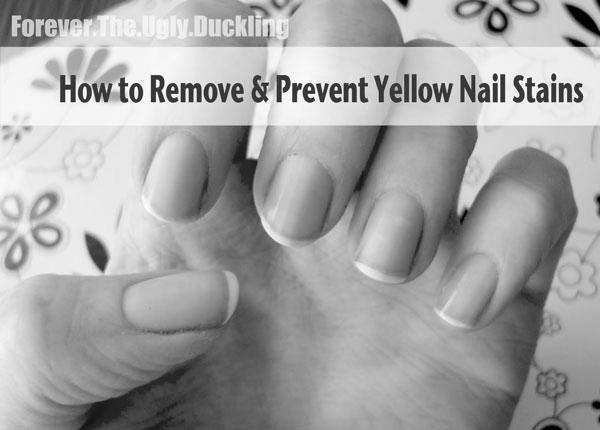 Why are my nails yellow? image 9