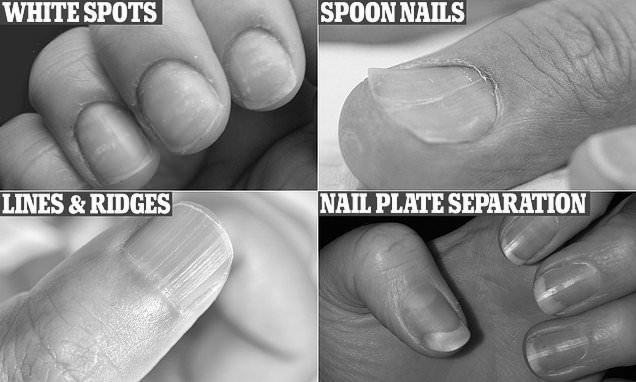 Why do nails go white at the end of them? image 3