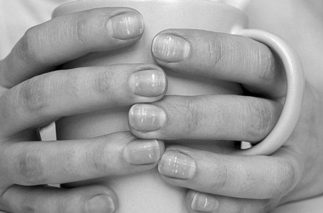 Why do nails go white at the end of them? image 6