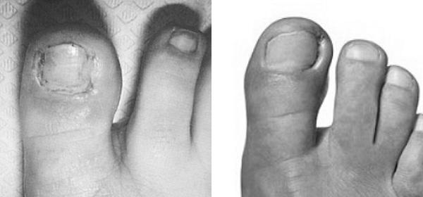 What doctor should I see for nail ailments? image 12