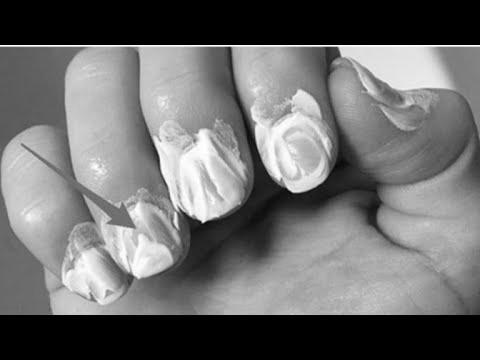 Does the toothpaste help nails to grow? photo 0
