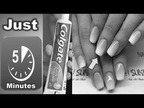 Does the toothpaste help nails to grow? photo 8
