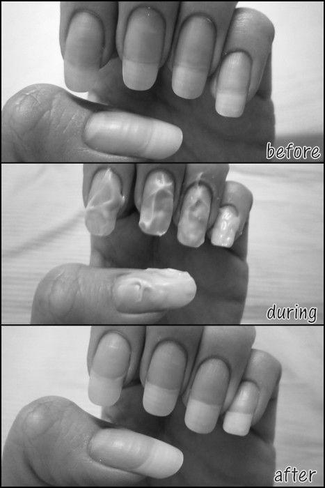 Does the toothpaste help nails to grow? photo 12