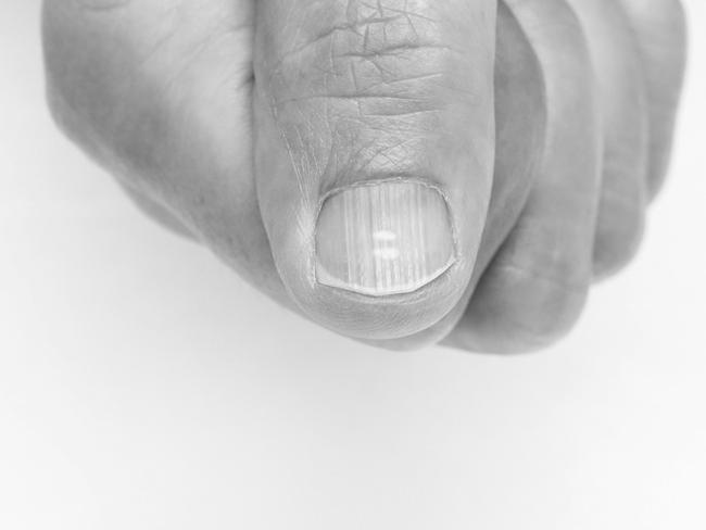 Are fast growing fingernails a sign of good health? photo 9