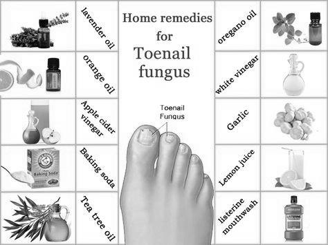 What are the natural treatments for nail fungus ? photo 3