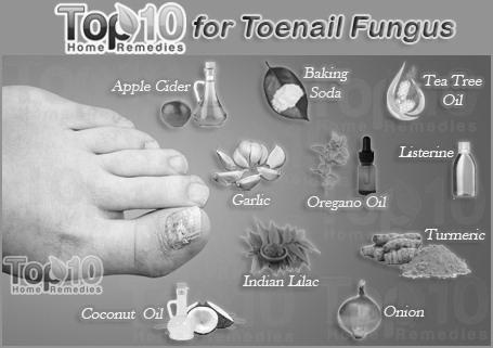 What are the natural treatments for nail fungus ? photo 6