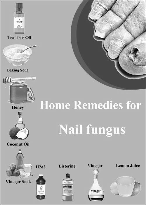 What are the natural treatments for nail fungus ? photo 7