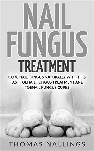 What are the natural treatments for nail fungus ? photo 0