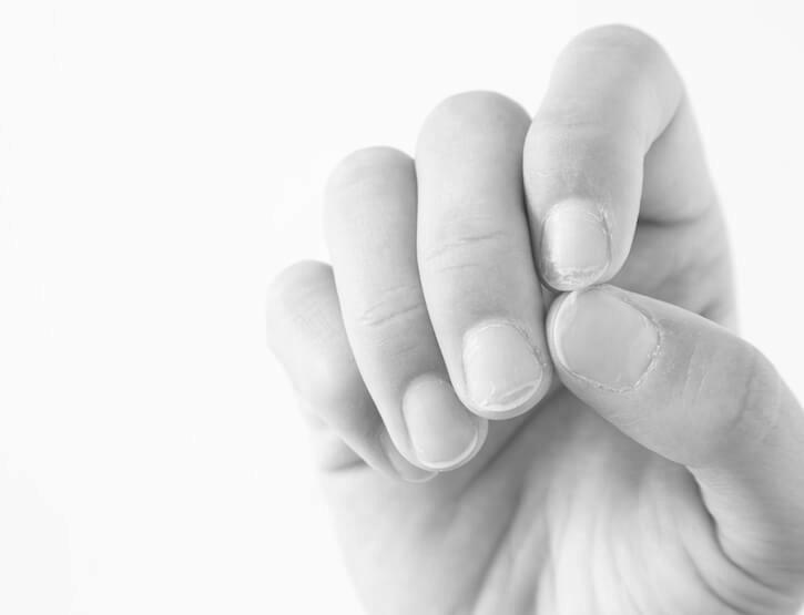 What is nail infection? image 9