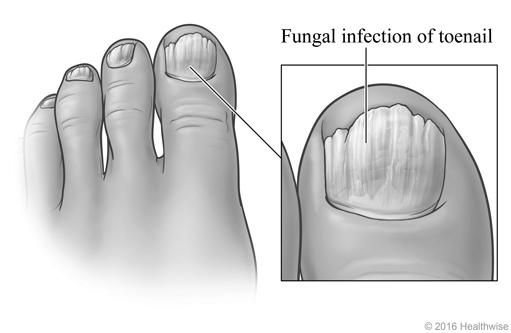 What is the significance of nails health-wise? image 13