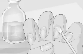 Why does the skin below the nails peel and cause huge pain? image 0