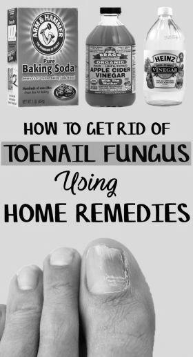 What are the natural treatments for nail fungus ? photo 5