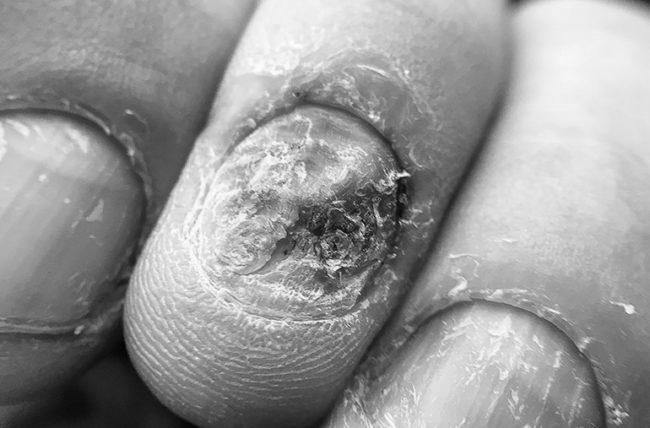 Can diseases really affect our nails? photo 8