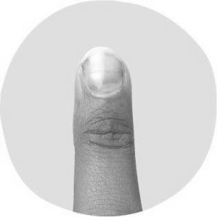 How does our finger nail indicate our health conditions? photo 8