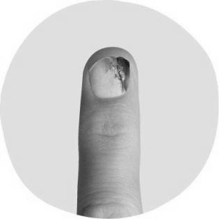 How does our finger nail indicate our health conditions? image 0