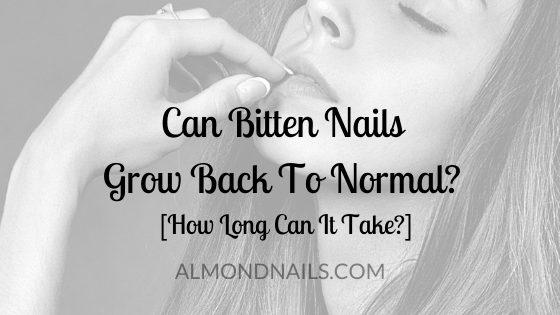 How do you heal short nail beds after years of nail biting? image 8