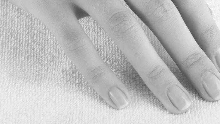Why do nails go white at the end of them? image 11