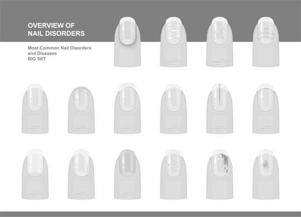 Why should we study nail disorders and diseases? photo 1