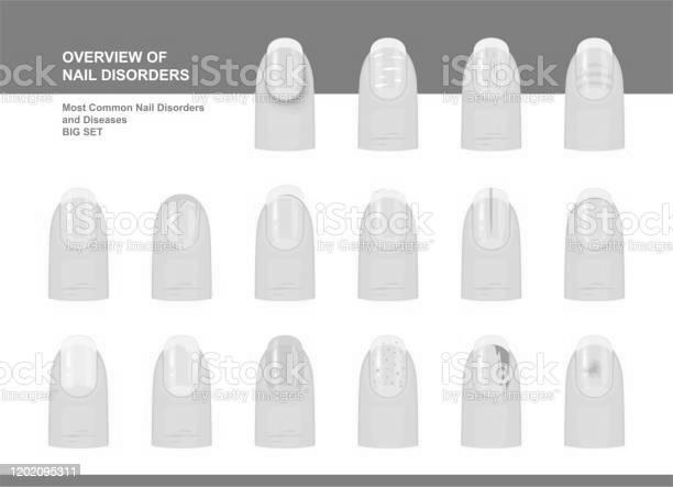 Why should we study nail disorders and diseases? photo 8