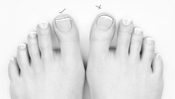 Is it better to clip or file fingernails and toenails? photo 7