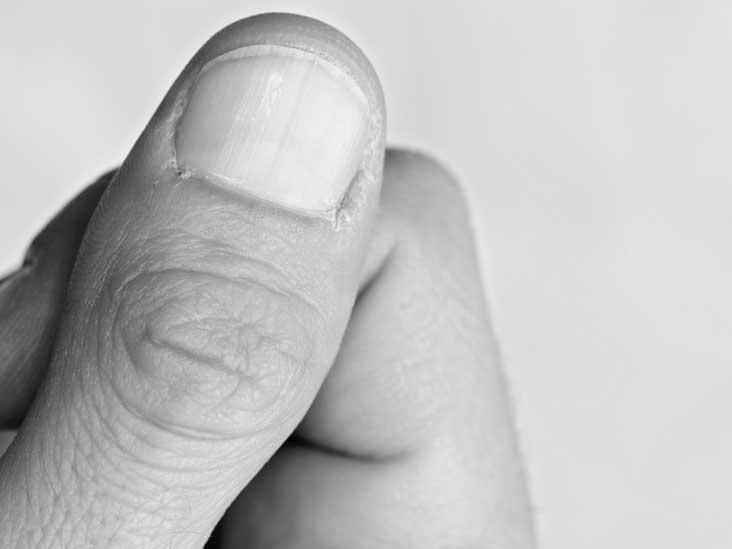 Why are fingernails hard? image 7