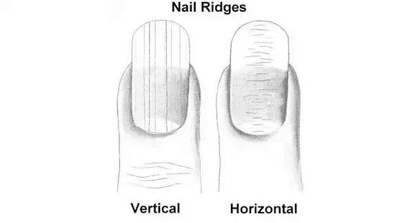Is it possible to reverse vertical nail ridges? photo 6