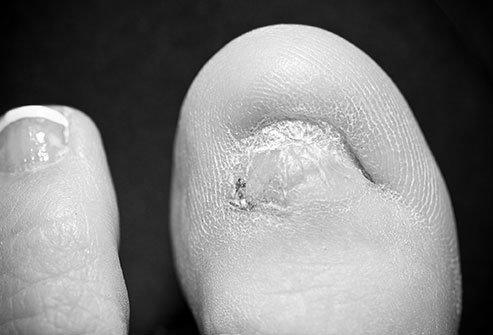 How long does it take for a big toe nail take to grow completely? image 3