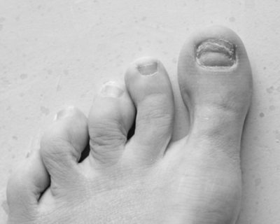 How long does it take for a big toe nail take to grow completely? image 5