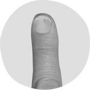 What can fingernails say about your health? image 9