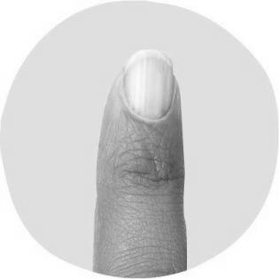 What can fingernails say about your health? image 12