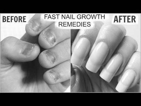 How to grow my nails? photo 5