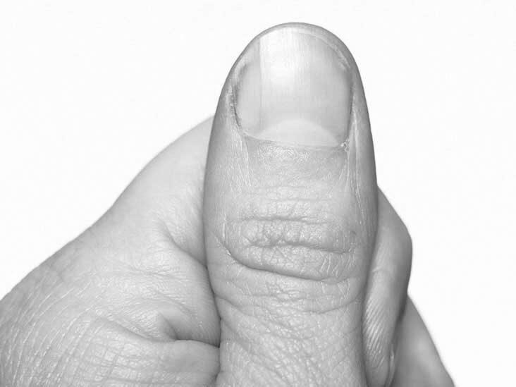 What is a normal rate for nails to grow? image 11