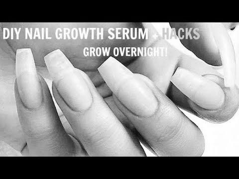 How to grow my nails? image 1