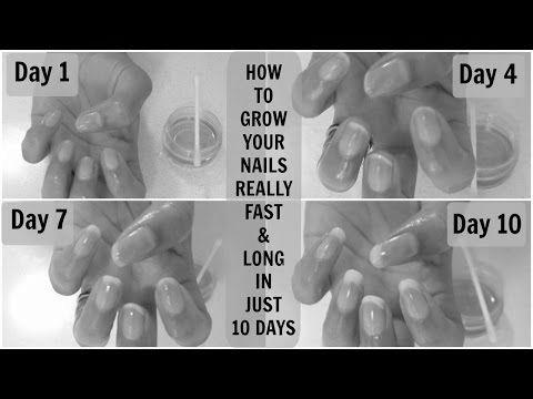 How to grow my nails? image 9