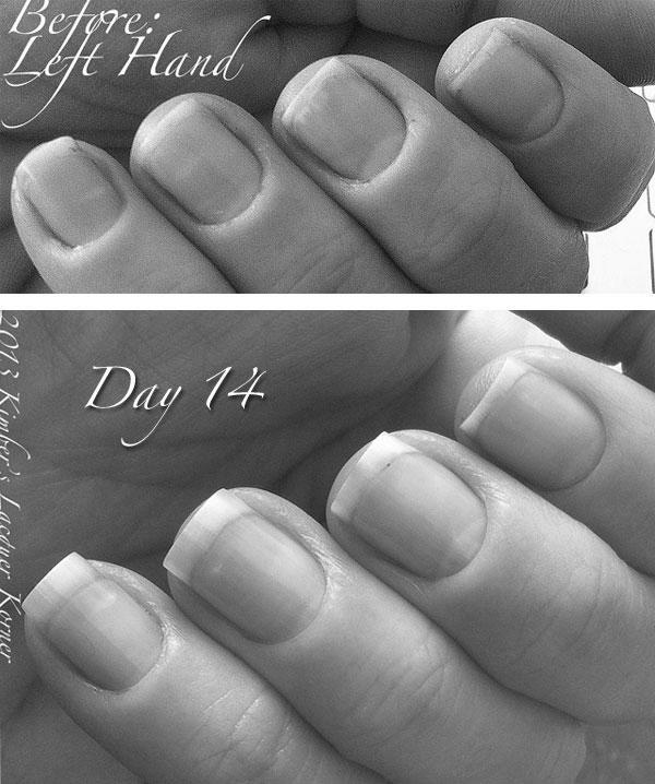 Is pushing cuticles back bad for nail growth? image 3