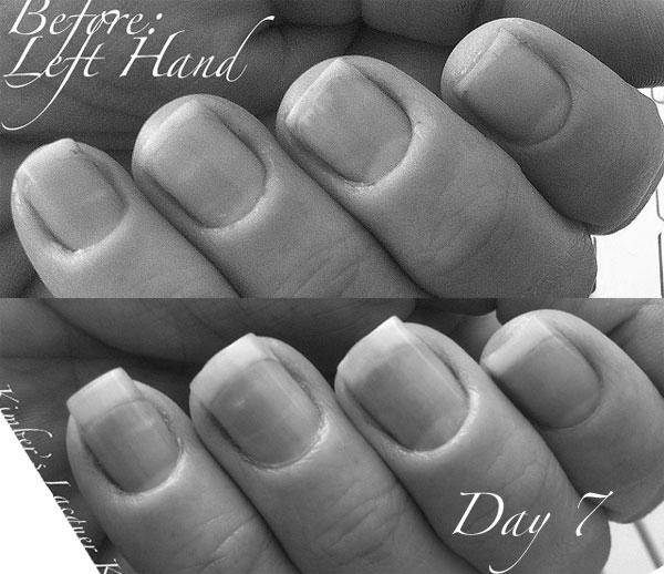 Is pushing cuticles back bad for nail growth? image 11