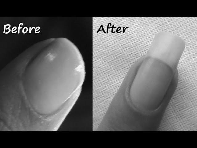 How do you help your nails grow more quickly in a week? photo 9