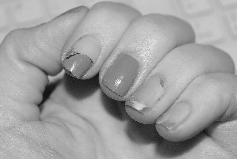 How do acrylic nails harm natural nails? photo 6