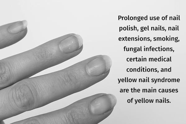 Why are your nails turning yellow and orange? photo 3