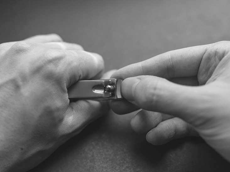 Why are your nails turning yellow and orange? photo 11